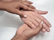 Hanseníase é caracterizada por manchas indolores e insensíveis