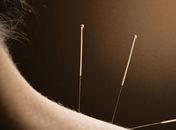 Pioneiro: Palmeira dos Índios implanta osteopatia e acupuntura no SUS