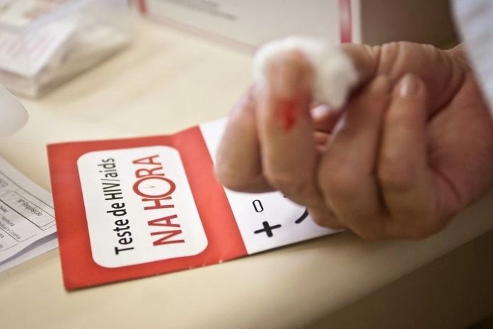 Teste de Aids e HIV