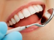 Sorriso "perfeito" no topo dos desejos adiados pela falta de dinheiro