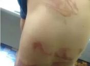 Garoto agredido