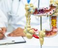 Alimento reduz em 20% o risco de câncer de intestino, revela novo estudo