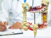 Alimento reduz em 20% o risco de câncer de intestino, revela novo estudo