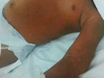 Rs=w:350,h:263,i:true,cg:true,ft:cover?cache=true