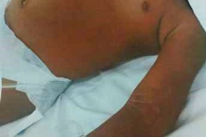 Criança de 2 anos está foi internada, devido a ferimentos provocados pelos espancamentos.