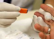 Anvisa discute liberar aplicação de teste para covid-19 em farmácias