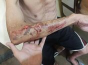 Idoso é espancado por casal dentro de casa em Arapiraca