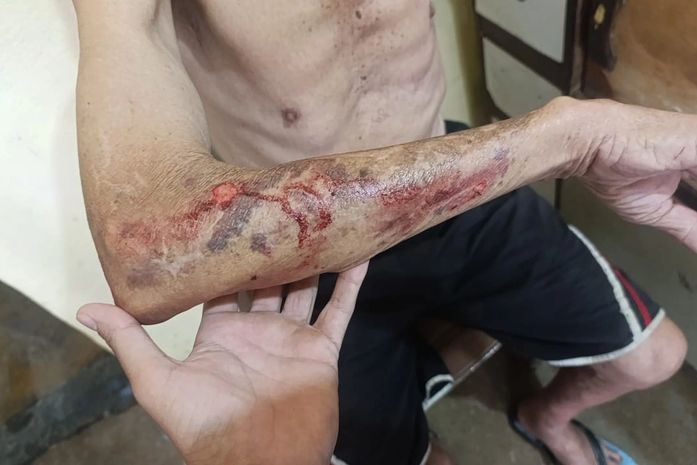 Idoso é espancado por casal dentro de casa em Arapiraca