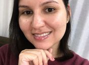 Você já teve sua autoestima afetada pela acne?