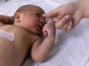 Teste do olhinho deve ser repetido três vezes ao ano até os 3 anos