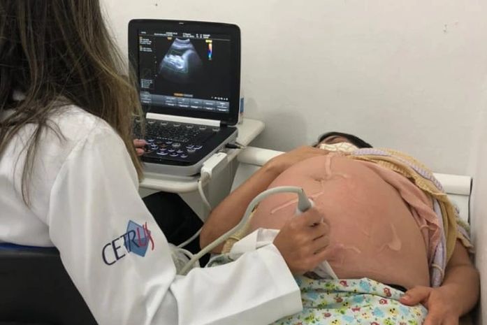 Prefeitura de Limoeiro contrata geriatra, pneumologista e ultrassonografista