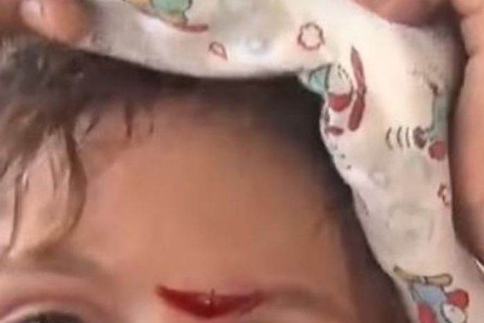 Mãe atira celular na testa da filha menor e é presa em flagrante por lesão corporal; menina foi levada à UPA com corte na testa