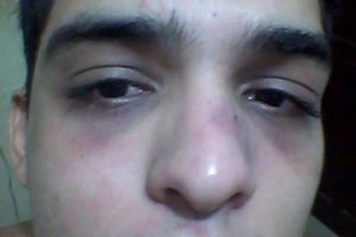Fábio: espancado por policiais