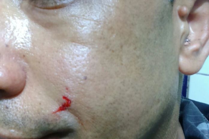 Militar mostra rosto ferido