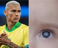 Richarlison doa R$ 60 mil para tratamento de bebê com catarata congênita em Alagoas