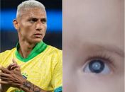 Richarlison doa R$ 60 mil para tratamento de bebê com catarata congênita em Alagoas