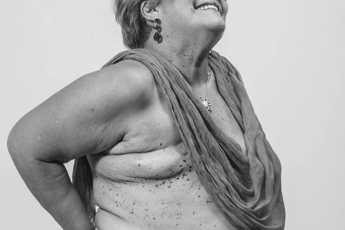 Exposições fotográficas marcam lançamento do Outubro Rosa nos shoppings de Maceió