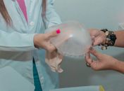 Prefeitura oferta prótese mamária externa a mulheres mastectomizadas