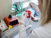 País tem 768 casos suspeitos da doença.