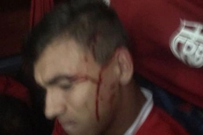 Ônibus do CRB é atacado com pedras, três jogadores feridos em Arapiraca