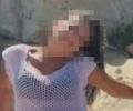 Mulher queimada pelo companheiro em Maceió perde a visão e o cabelo; estado segue gravíssimo