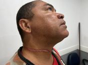 Mototaxista se enrosca em fio e fica ferido no pescoço em Marechal Deodoro