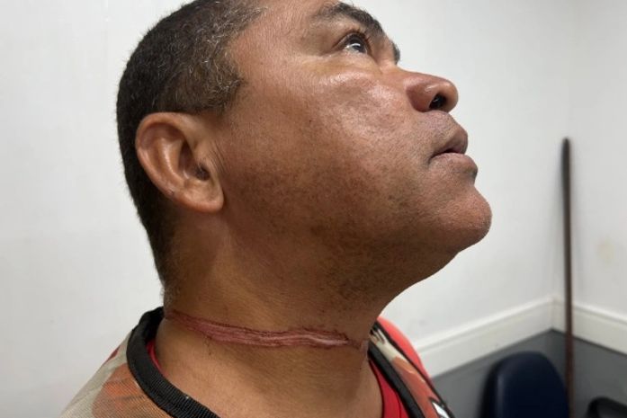 Mototaxista se enrosca em fio e fica ferido no pescoço em Marechal Deodoro