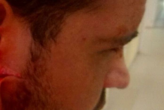 Corte atingiu da orelha até próximo a nuca