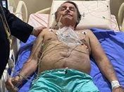 Presidente foi internado nesta manhã após sentir dores abdominais; segundo a Secom, foi identificada uma obstrução intestinal decorrente da facada que o ele levou em 2018