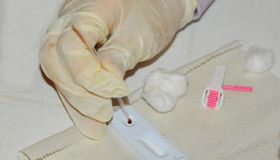 Nova edição do Projeto Alagoas Vigilante vai monitorar as infecções sexualmente transmissíveis