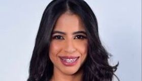 Estudante de Alagoas tem trabalho selecionado para maior evento em Odonto do Brasil