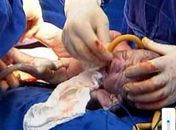 BCU-Brasil: Arapiraca ganha banco para coleta de células-tronco