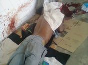 Morador de rua é encontrado morto em frente ao Estádio Municipal