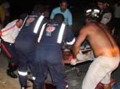 Criança de 2 anos tem perna decepada ao ser atingida por veículo