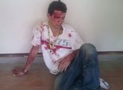 Jovem tenta atirar em "perueiro", arma falha e ele acaba espancado e preso por populares