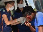 Motorista atropela motociclistas na AL220 e foge sem prestar socorro