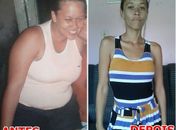 Jovem com problema renal busca ajuda para realização de cirurgia