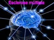 Esclerose Múltipla será debatida durante evento em Arapiraca