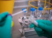 Arapiraca registra 23 novos casos de Covid-19 nas últimas 24h