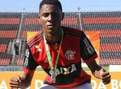 Melhora quadro de saúde de Jhonata, que teve 35% do corpo queimado em CT do Fla