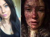 Covardia! Jogador espanca namorada e ela mostra o estrago nas redes sociais