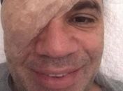 Comentarista de TV sofre descolamento de retina e tranquiliza fãs na Internet