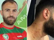Jogador turco ataca rivais em campo com lâmina e é banido do futebol