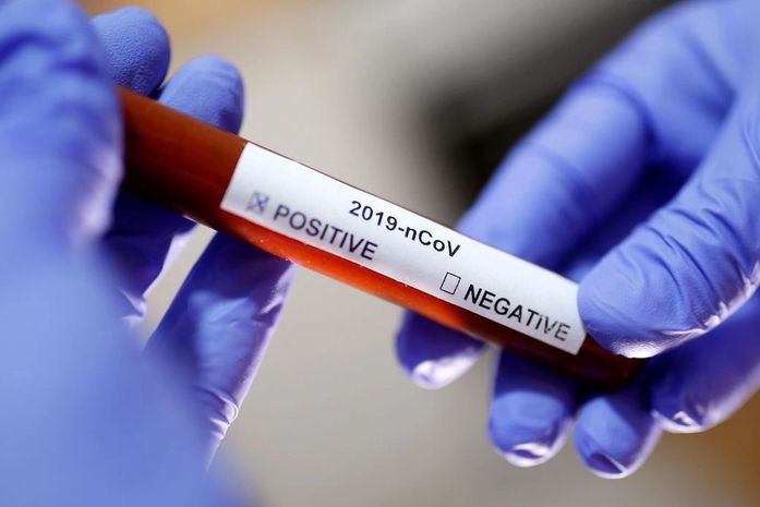 Covid-19: Brasil registra 67.860 novos casos confirmados em 24h