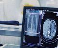 Vereadora solicita Tomografia Computadorizada e proibição de fogueiras para não agravar situação de pacientes de COVID 19