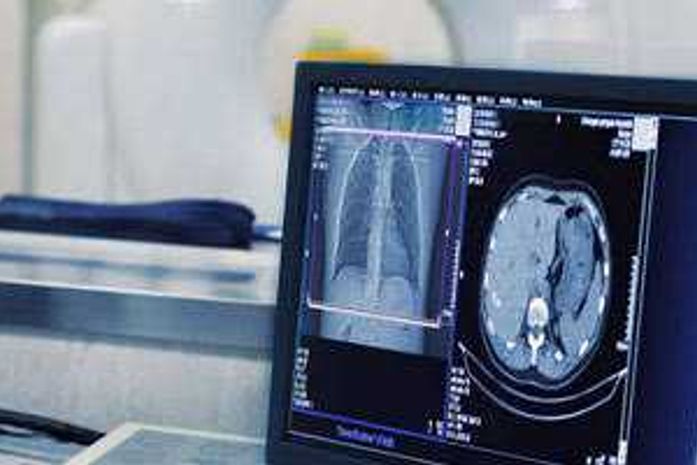 Vereadora solicita Tomografia Computadorizada e proibição de fogueiras para não agravar situação de pacientes de COVID 19