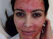 Duas pessoas podem ter contraído HIV após lifting de vampiro nos EUA