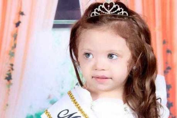 Menina com síndrome de Down vence concurso de beleza infantil