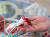 Cafeína pode melhorar a função pulmonar de bebês prematuros na vida adulta