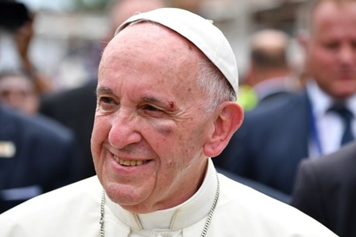 Papa se desequilibra, bate a cabeça e machuca olho esquerdo
